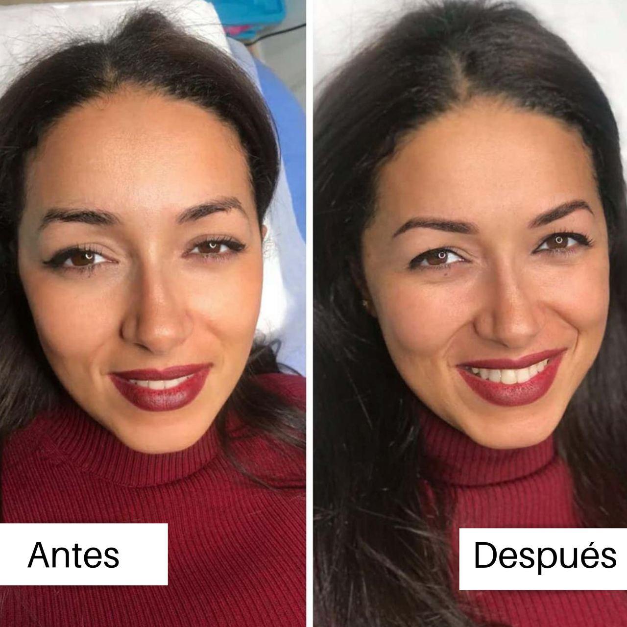 Comparativa del resultado en la mirada