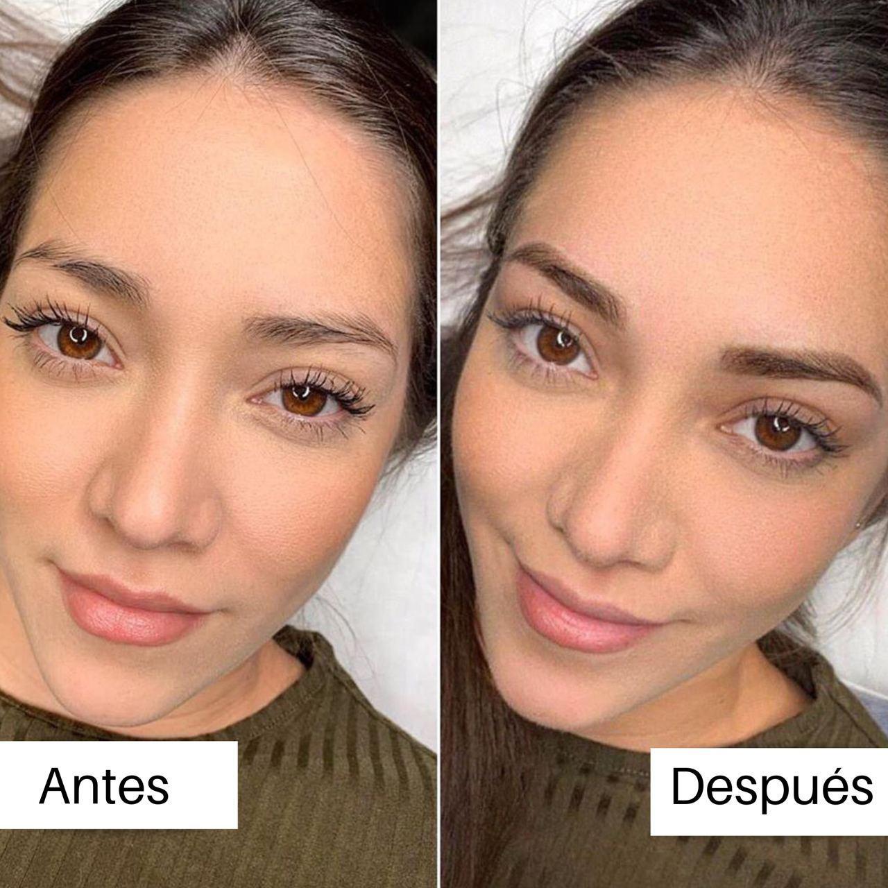 Comparativa del rostro antes y después del tratamiento